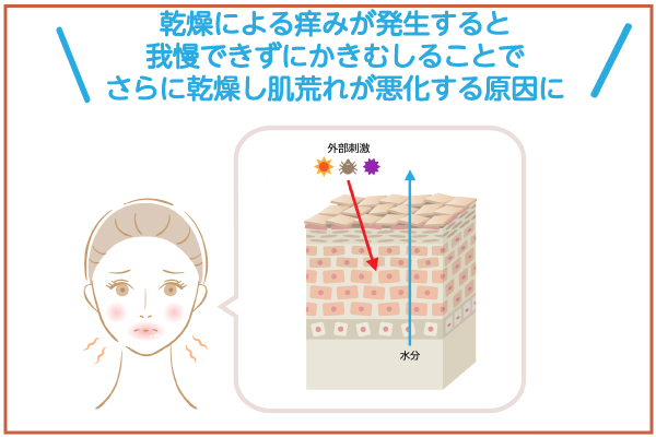 肌断面図